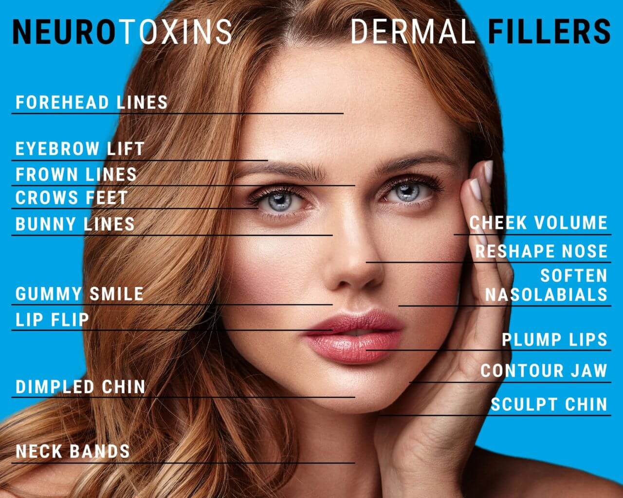 Beautiful woman with perfect face promoting Dermal filler and Neurotoxin treatment areas in Strongsville, OH
