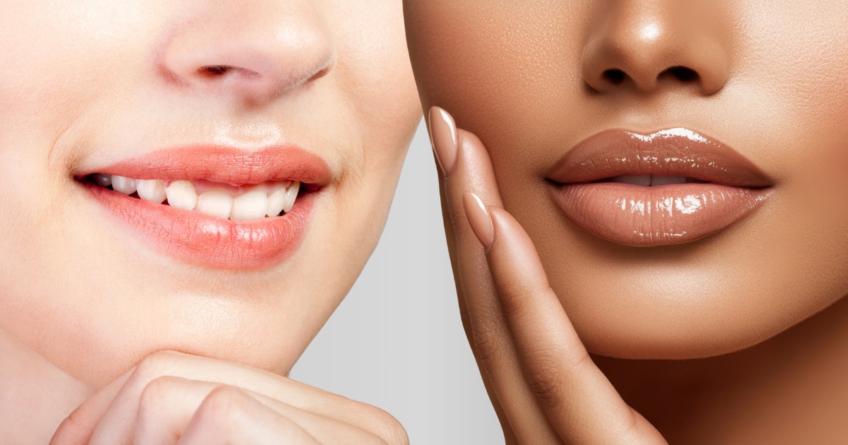 Close-up of two models—one with natural-looking lips, one with fuller, dramatic lips—smiling confidently
