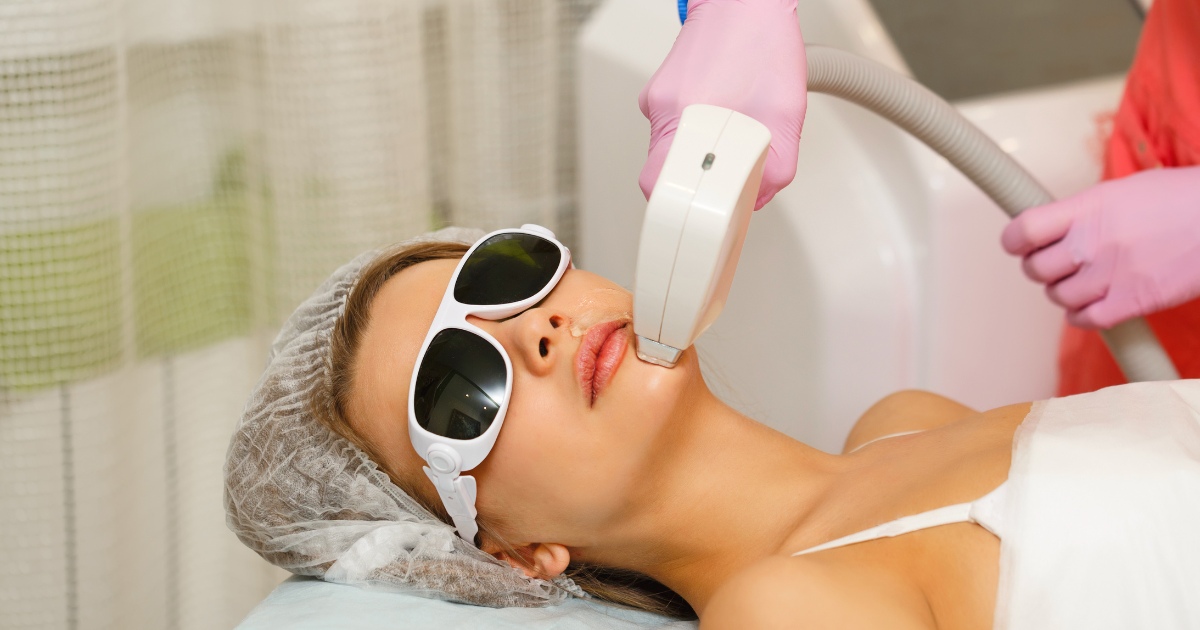 a woman lying down in a clinic or spa setting while receiving a cosmetic laser treatment on her upper lip.